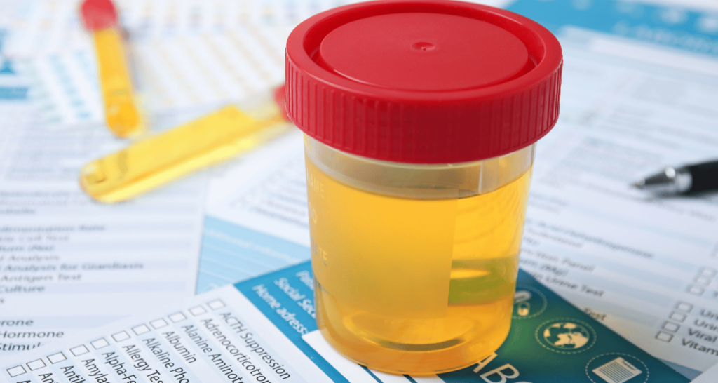 Does Ketamine Show Up on a 12 Panel Drug